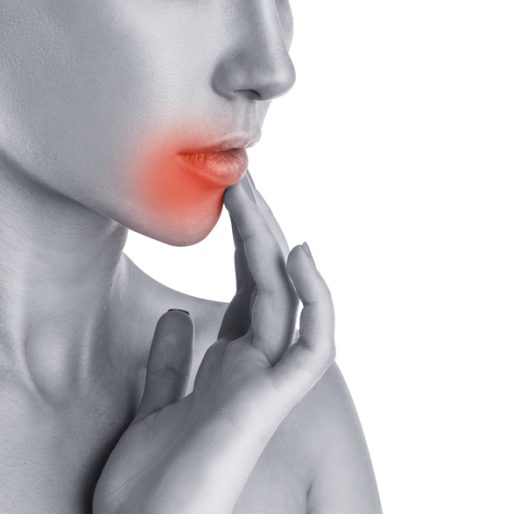 헤르페스 감염이 따끔거림, 화끈거림, 물집, 궤양, 딱지 순서로 나타날 수 있음을 설명하는 이미지